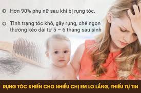 RỤNG TÓC SAU KHI SINH???